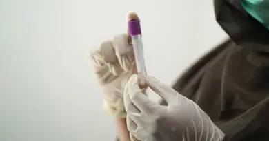 Diagnostic RSE